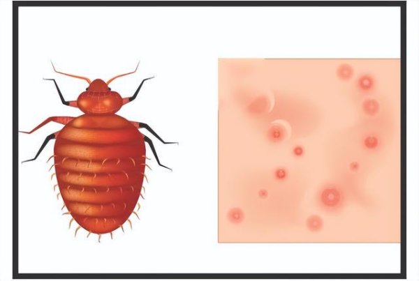 658配资 几乎绝迹的床虱“卷土重来”，专家手把手教你科学防虫